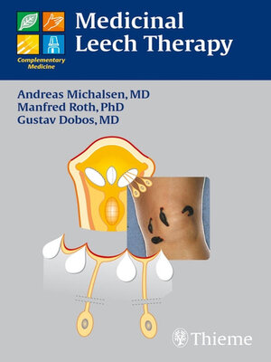 cover image of Medicinal Leech Therapy